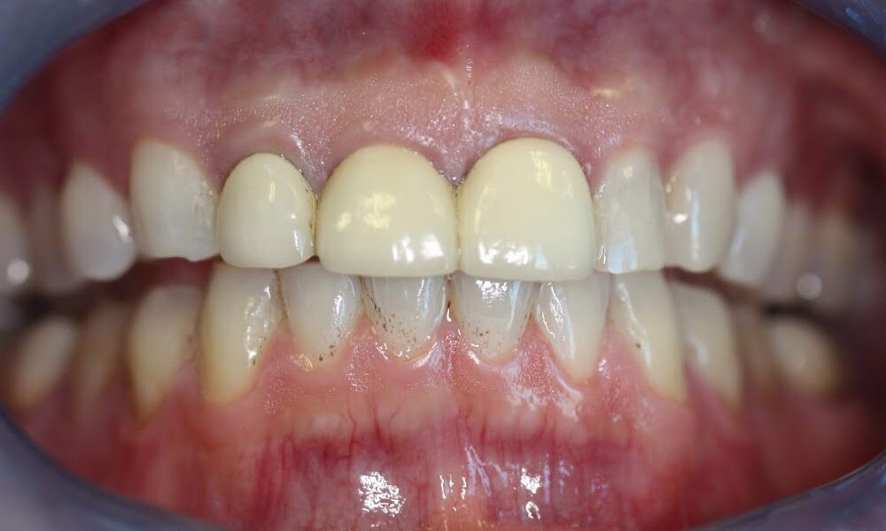 Warehouse District Dental Focus on Smiles